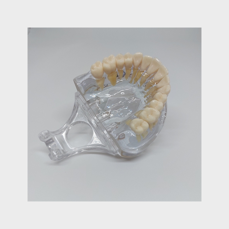 Transparent Kbemodel med Tnder 